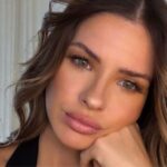 La China Suárez se sometió a una intervención en su rostro, mostró el resultado y explicó por qué lo hizo