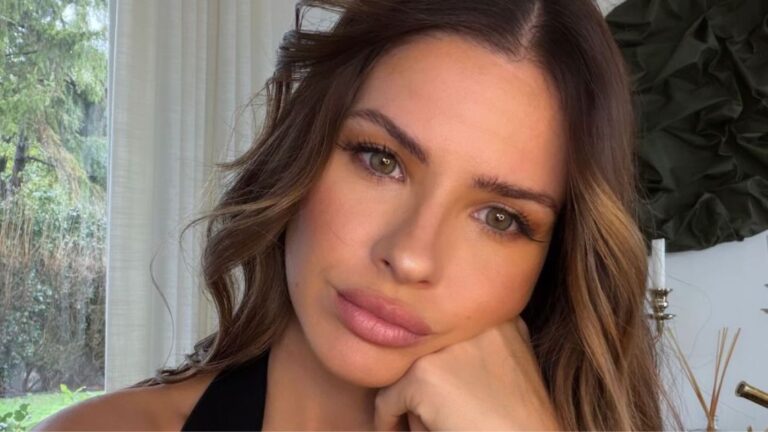 La China Suárez se sometió a una intervención en su rostro, mostró el resultado y explicó por qué lo hizo