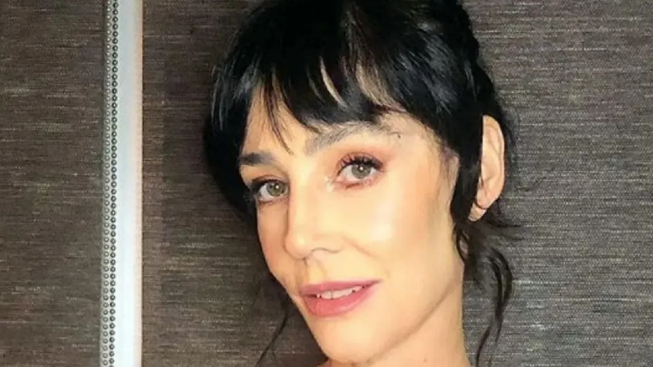 Paola Krum revela cómo un accidente cambió su vida: "Me dejó mal" 1 Paola Krum revela cómo un accidente cambió su vida: