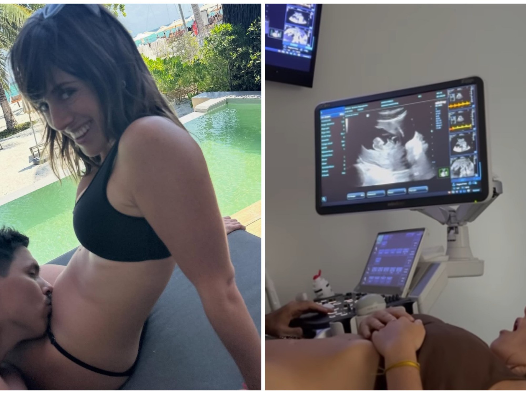 Micaela Lapegüe anunció que está embarazada: "La locura más linda de nuestras vidas"